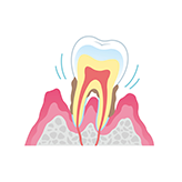 歯周病、歯周炎、歯槽膿漏の原因解明を徹底的に行います。